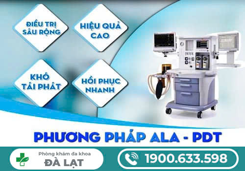 Hình ảnh minh họa